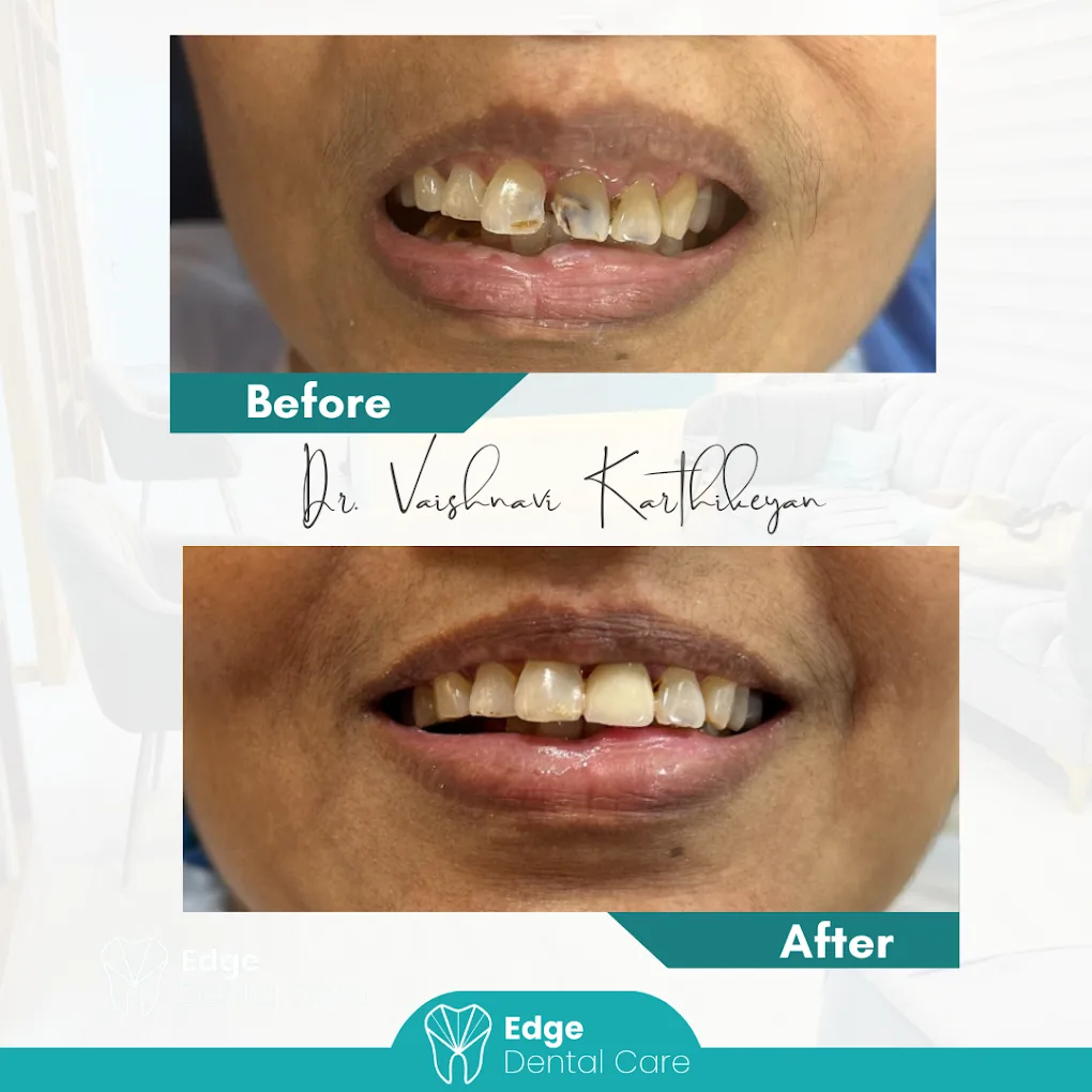 Image showing Patient before and after image