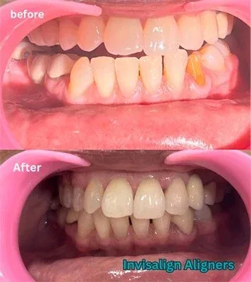 Image showing Patient treatment status