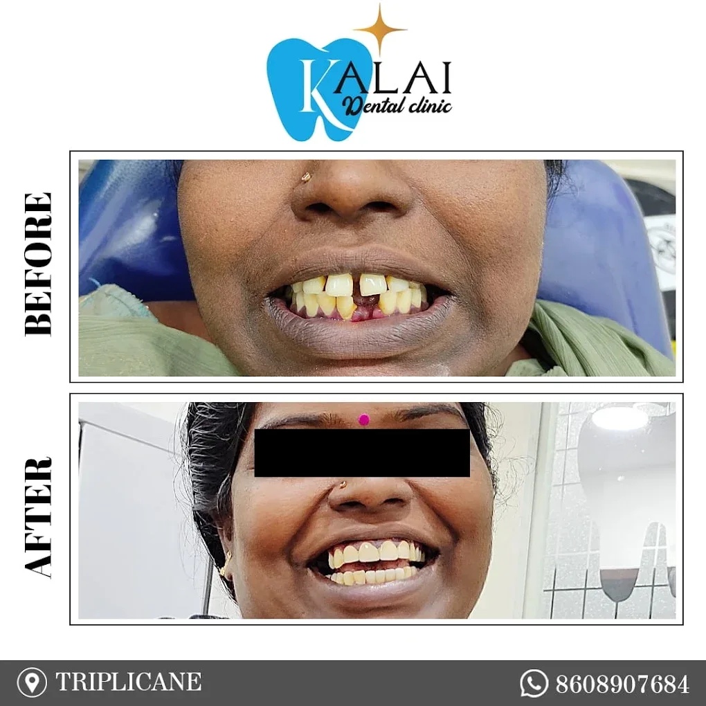 Image showing a happy patient