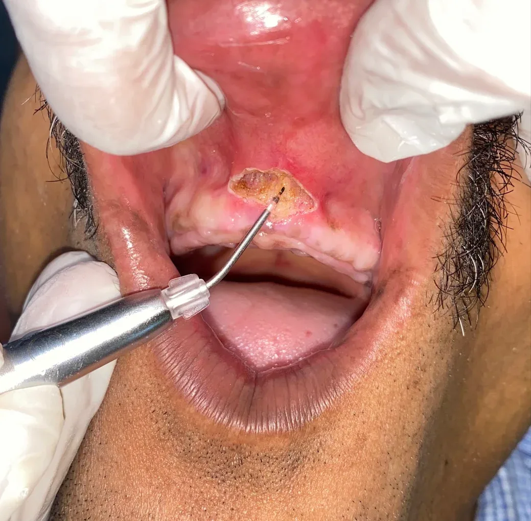 Treatment images