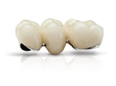 Image showing bridge connecting teeth