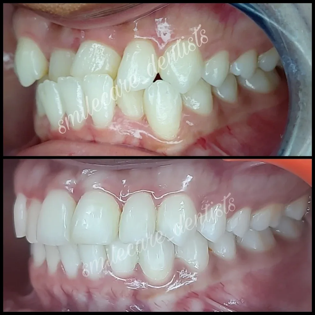 patient treatment images before and after
