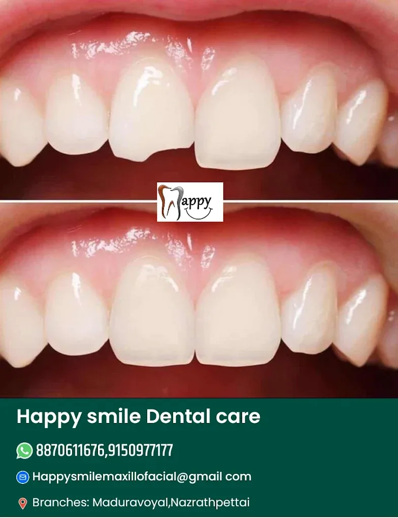 treatment teeth images