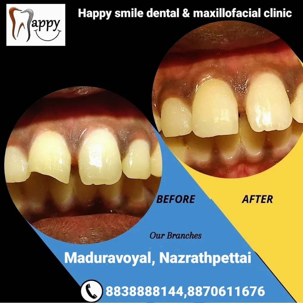 before and after treatment images
