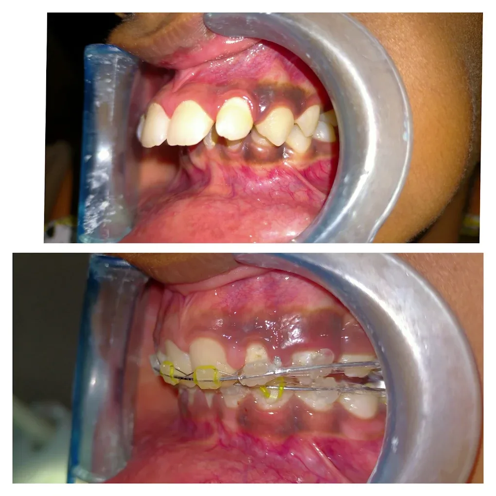 patient before and after images