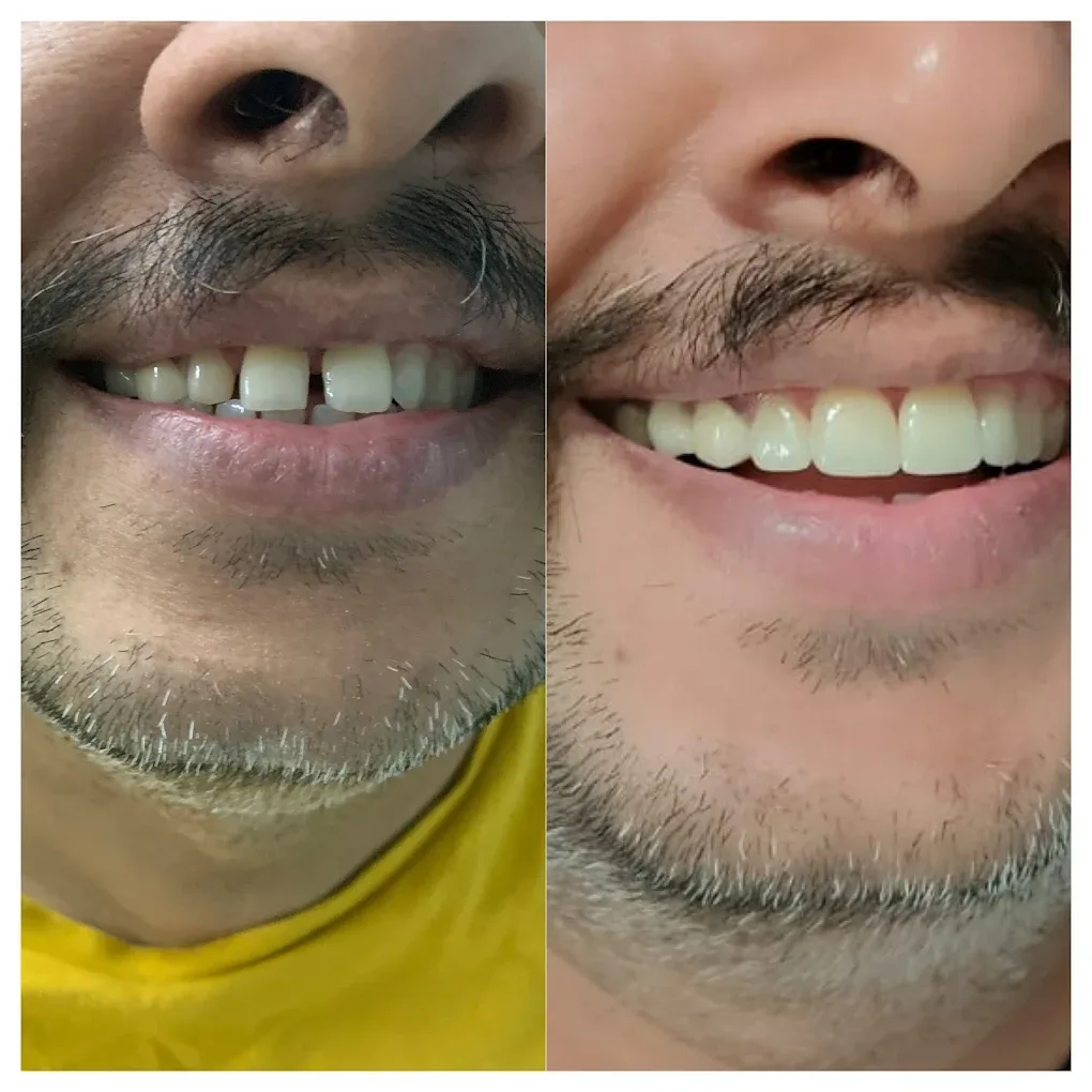 patient treatment result images