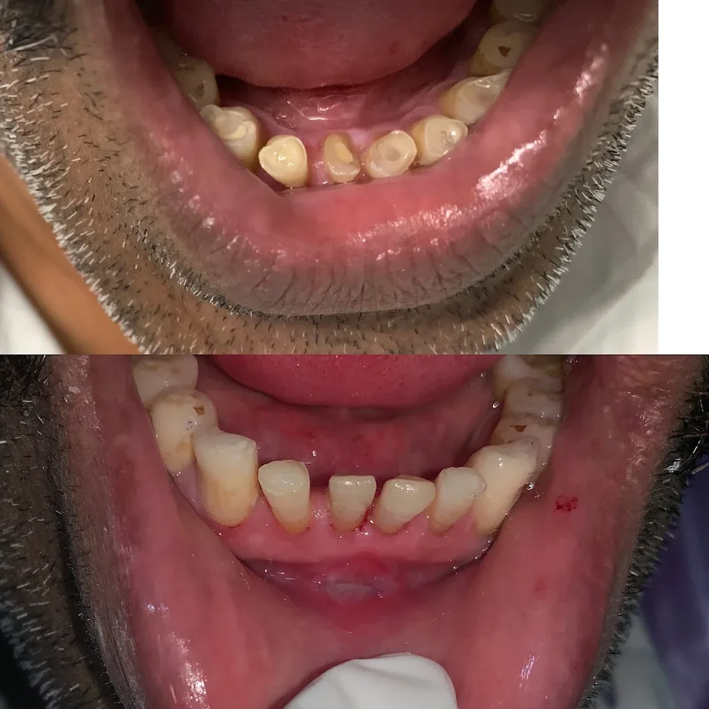 treatment before and after images