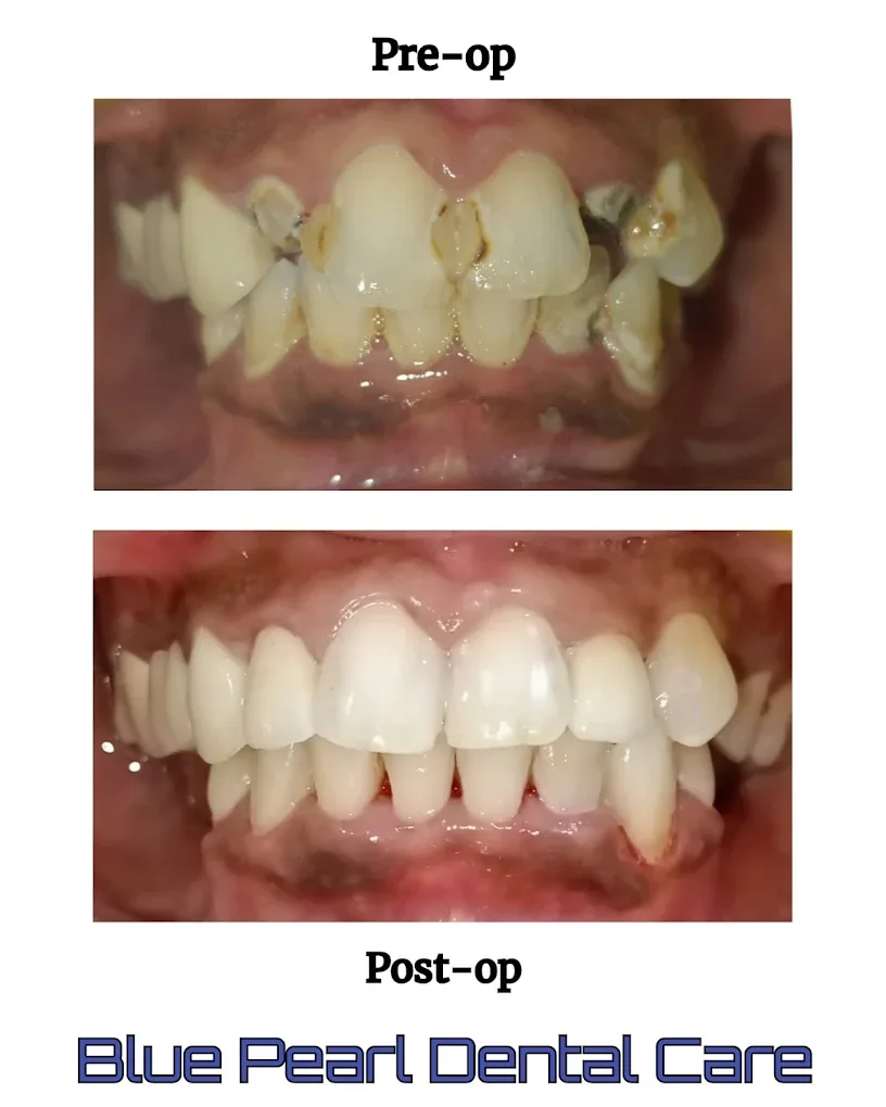 before and after treatment images
