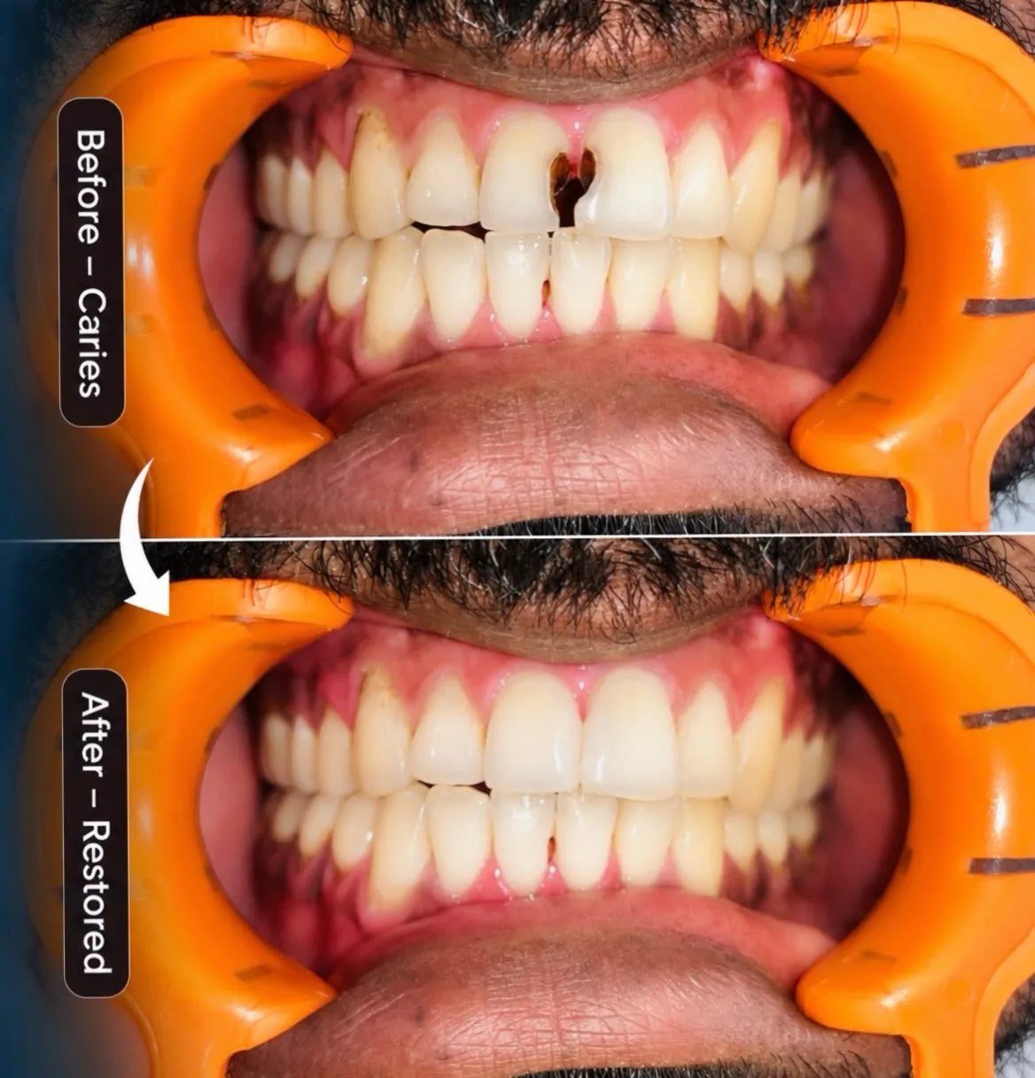 patient before and after treatment images